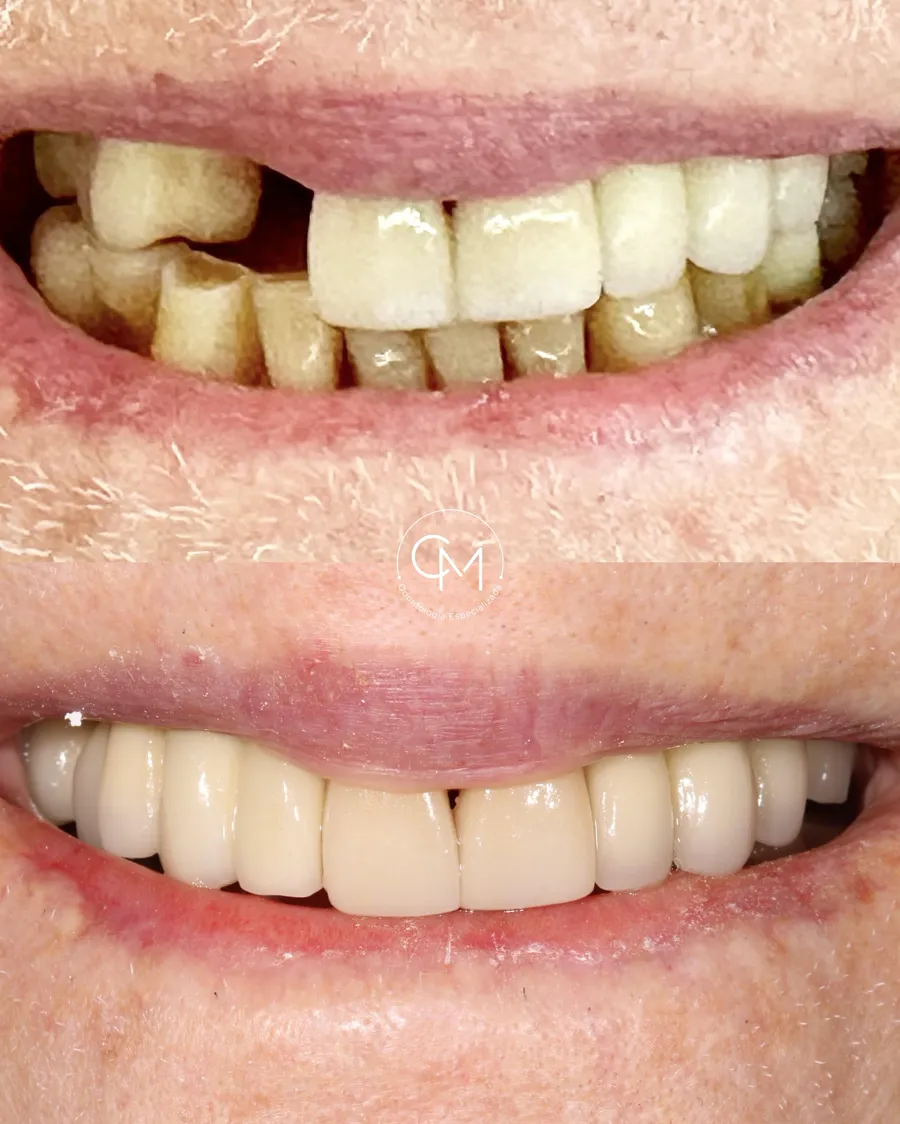 Antes e depois de paciente da clínica, caso 1