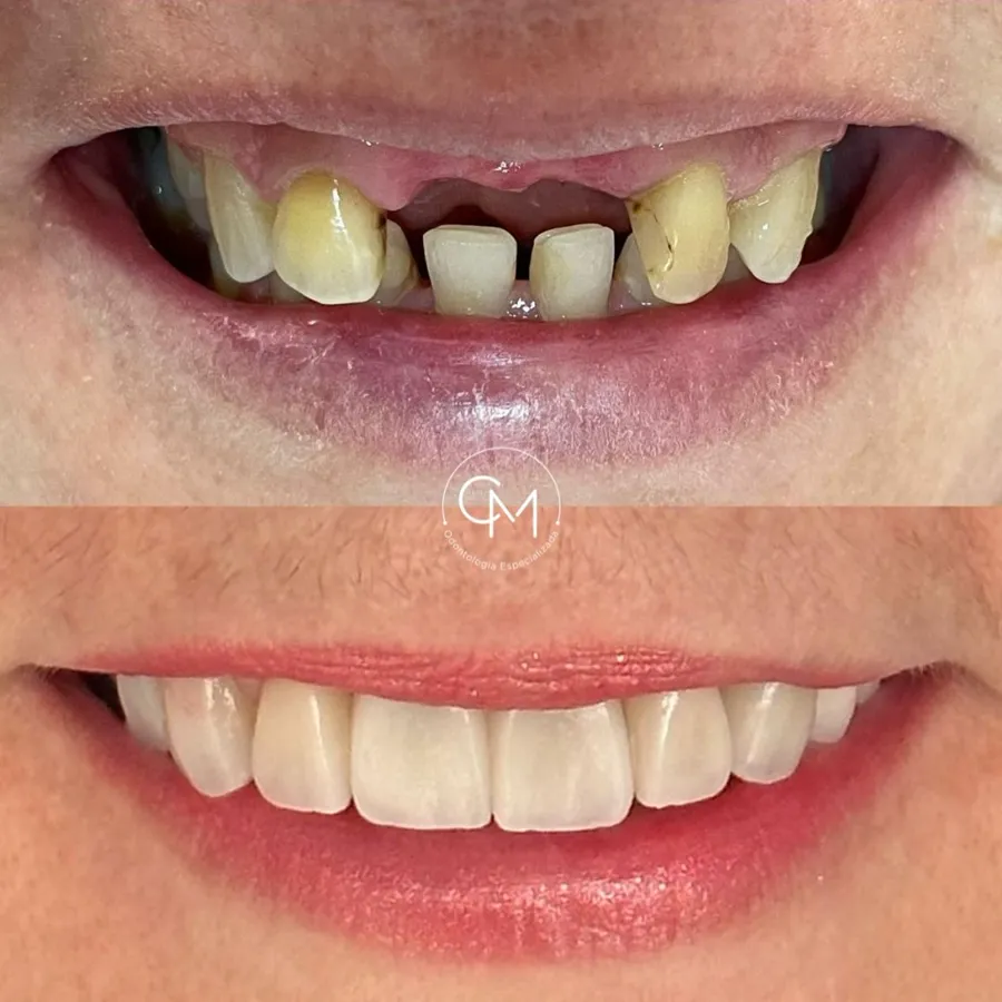 Antes e depois de paciente da clínica, caso 3